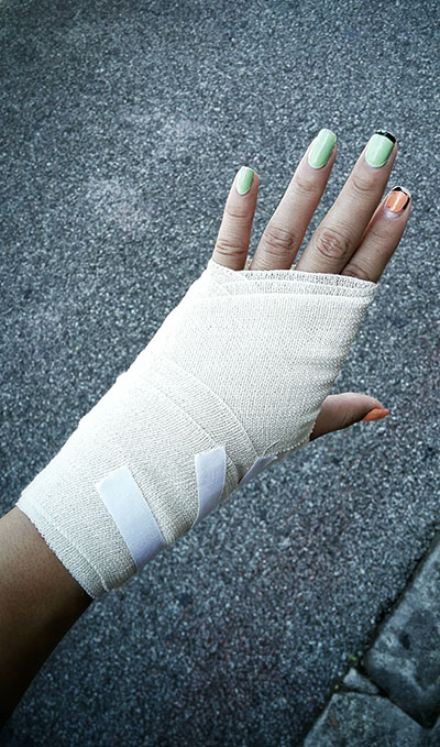 injured hand kali injury
